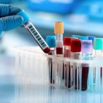 tbl_articles_article_32761_822f223d889-bd39-4200-aa52-ee845b36f09d-800x400